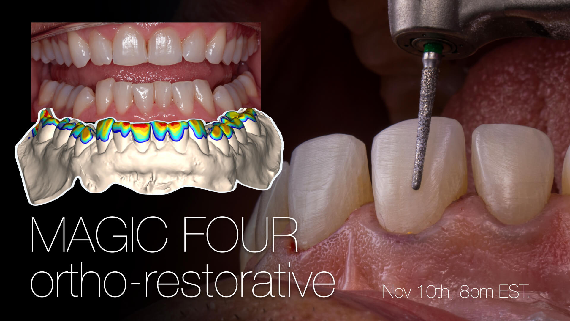 Magic Four: Ortho-Restorative Part 1